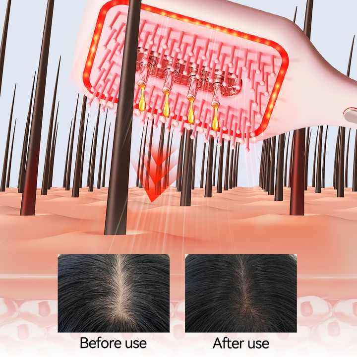 Therapy Air Cushion Hair Growth Comb Scalp Massager Brush - Airbag EMS for Hair Growth