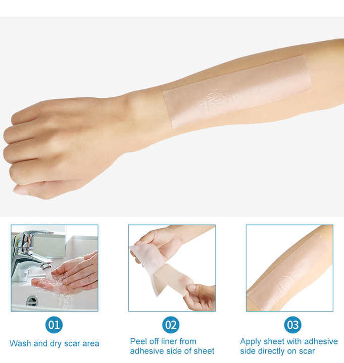 Soft Medical Silicone Gel Tape First Aid