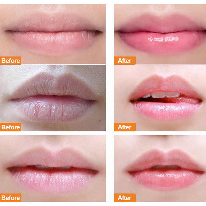 Lip scrub - Transparent scrub