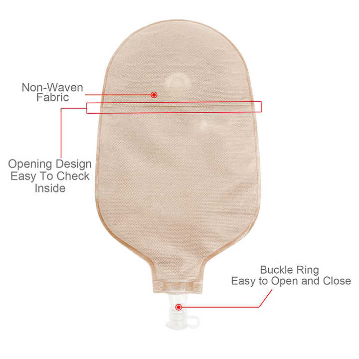 Urostomy bag first aid