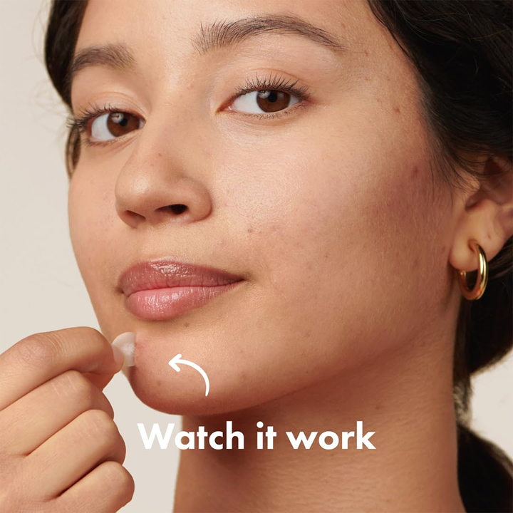 لحب الشباب اسعافات اوليه