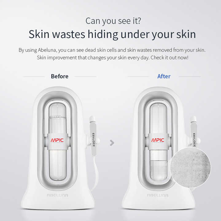 Abeluna aqua peeling device