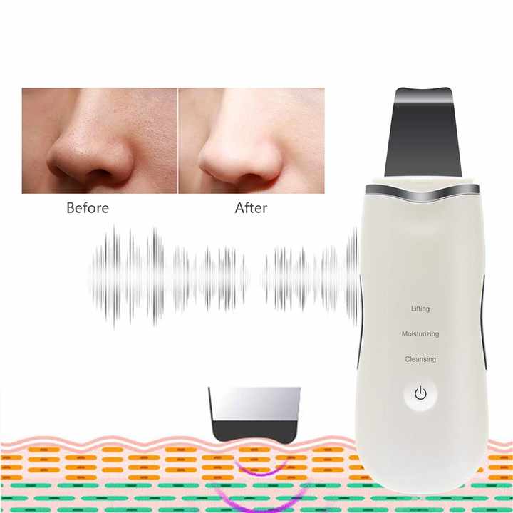 Electric Dead Skin Scrubber Peeling 