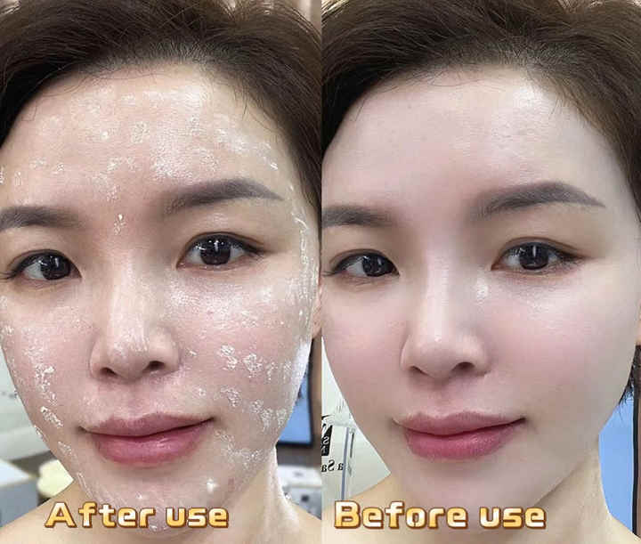YIYIMEI Whitening Freckle Removal-Face Whitening Cream 