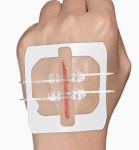 Disposable Zipper Wound Closure First Aid 