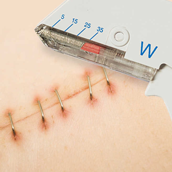 عالية الجودة الطبية معقمة الجلد جهاز إغلاق الجرح اسعافات اوليه