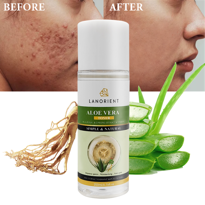 Facial Skin Damage Aloe Vera Anti-Acne Toner for Face - Skin Care Products from Korea