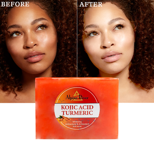Dark Spots Turmeric Soap for Women - Korean Skin Care Product, Facial Cleanser 