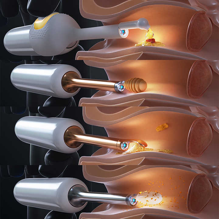 Ear with artificial intelligence 