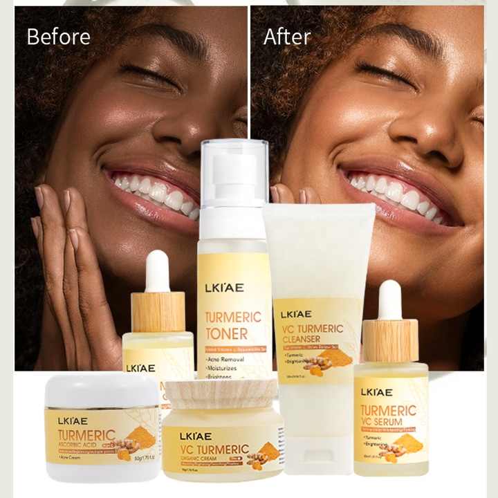 Oily Skin Care Set - Beauty Products 