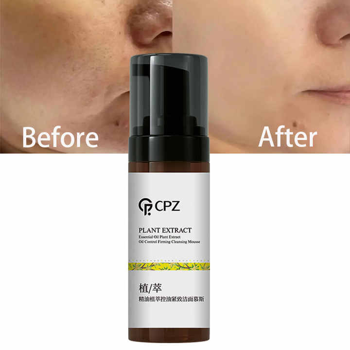 CPZ Moisturizer 