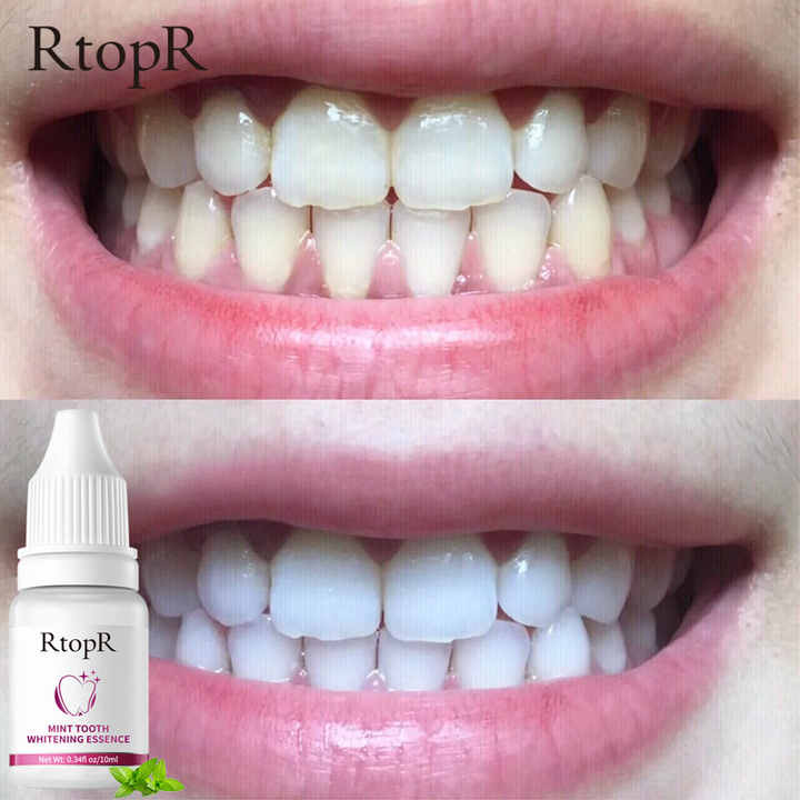 teeth whitening and care product