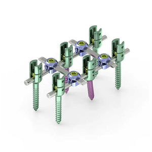 column system 