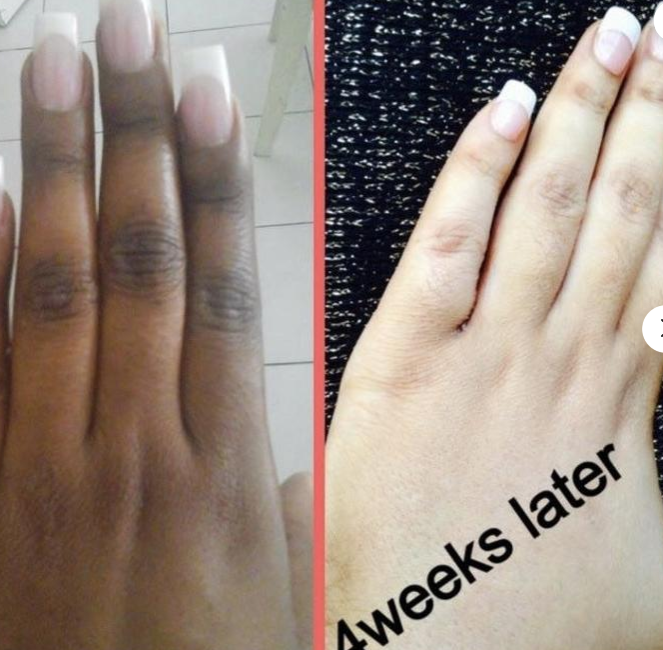 اطقم العنايه - أفضل كريم تبييض البشرة الكوري