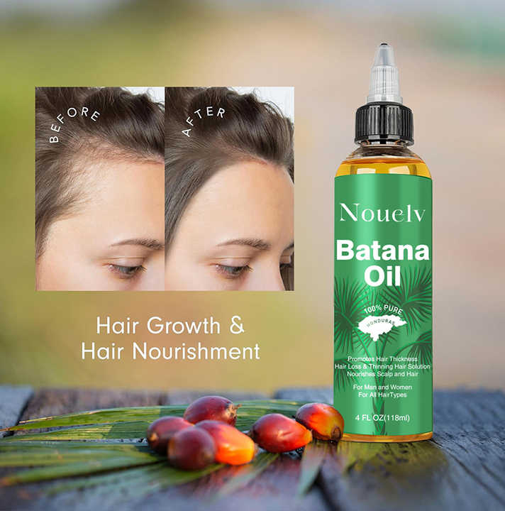 hair oil 