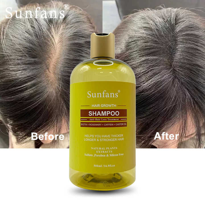hair growth shampoo 