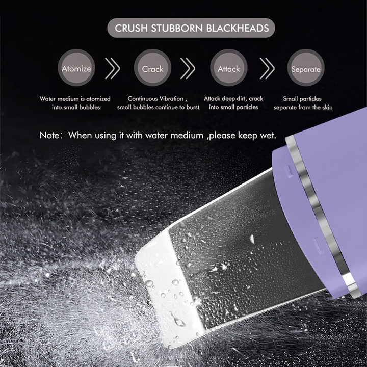 Ultrasonic skin peeling device 