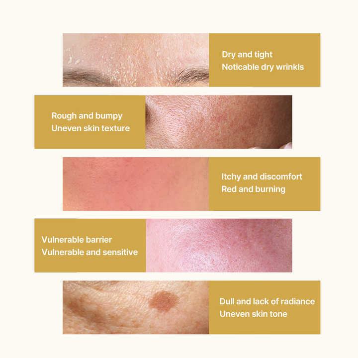 اطقم العنايه - سيروم النياسيناميد، خلاصة الكولاجين للوجه