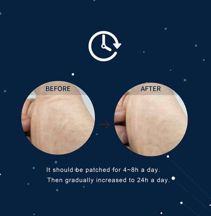 شريط من السيليكون لازالة آثار حب الشباب, يمكن  .  Silicone strip for removing acne scars,