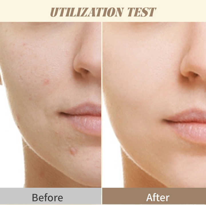 وسادات قناع الوجه فائقة الرقة - اطقم العنايه