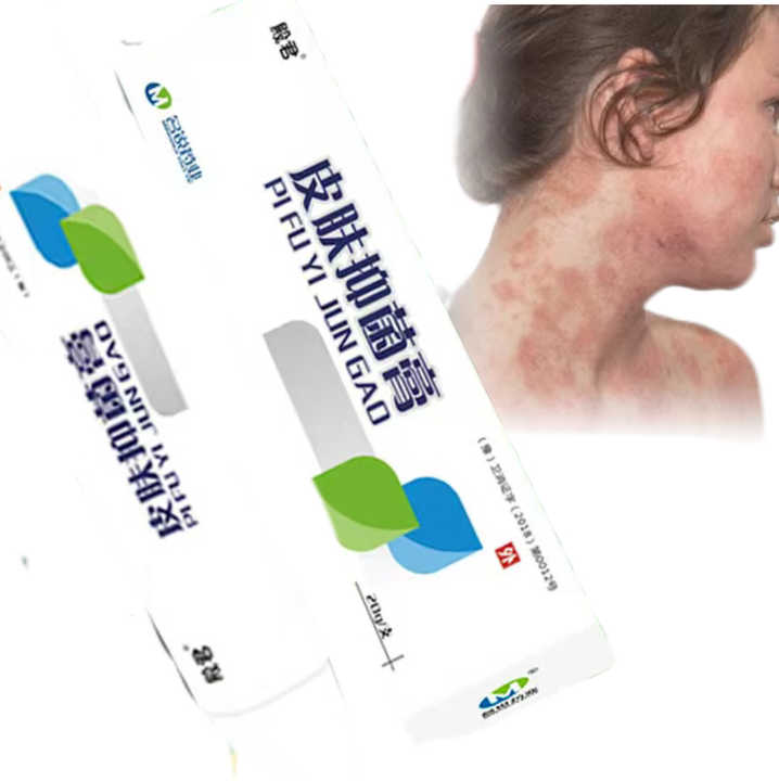 Professional Herbal Skin Bacteriostatic Ointment 