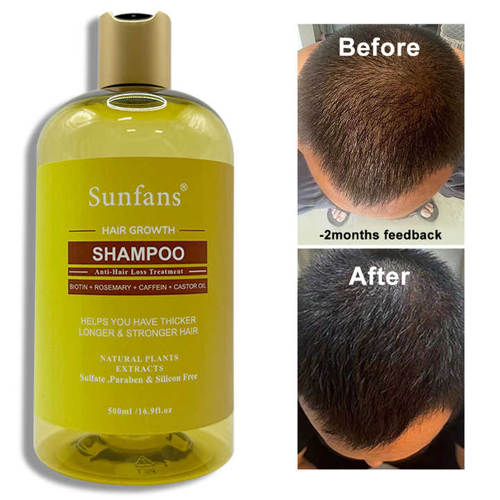 hair growth shampoo 
