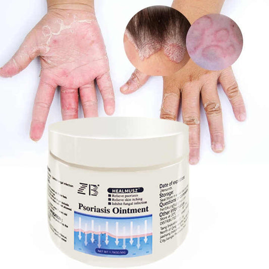 ZB Psoriasis Cream for Dermatitis and 