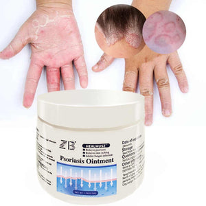 ZB Psoriasis Cream for Dermatitis and 