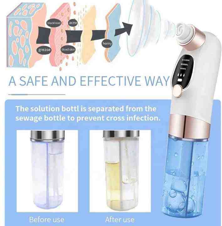 Blackhead vacuum remover 