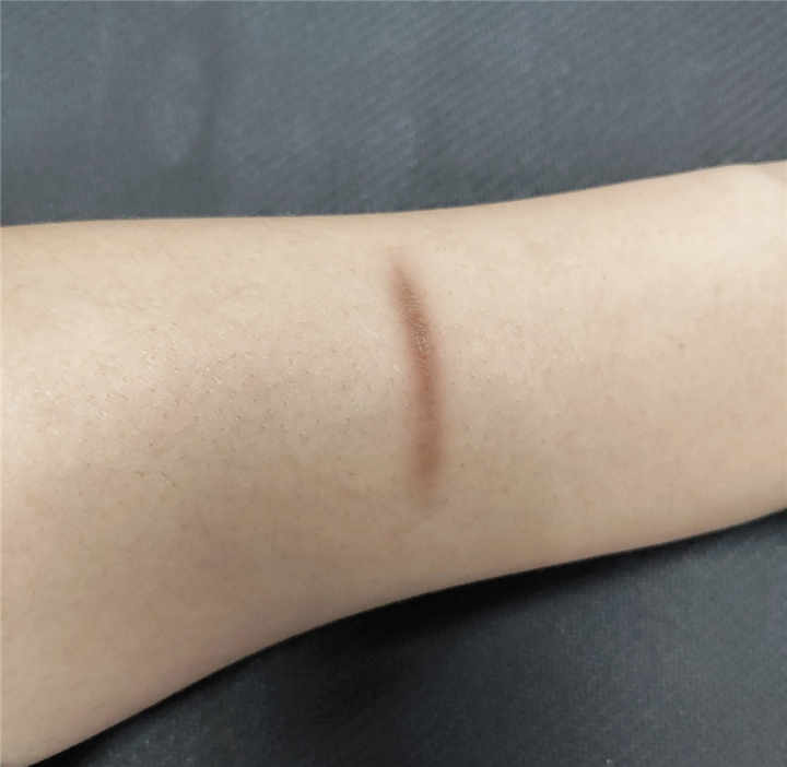 ورقة وسادات جل سيليكون طبية للندوب اسعافات اوليه