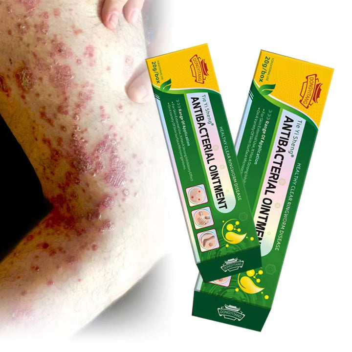 Professional Herbal Skin Bacteriostatic Ointment 