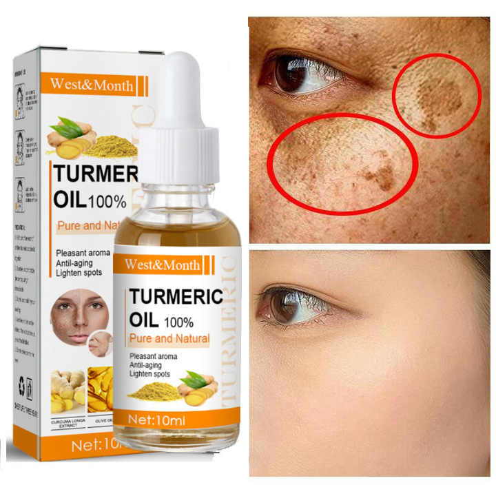 Remove Dark Spots Turmeric Essential 
