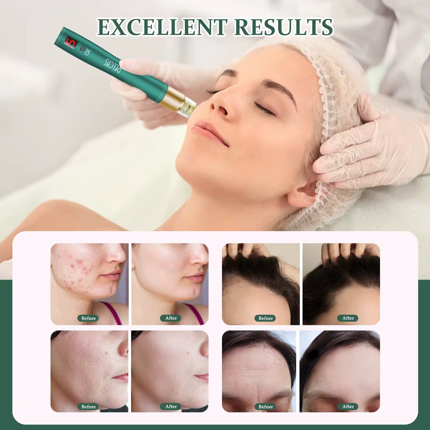 Mini Skin Care Pen Beauty Device